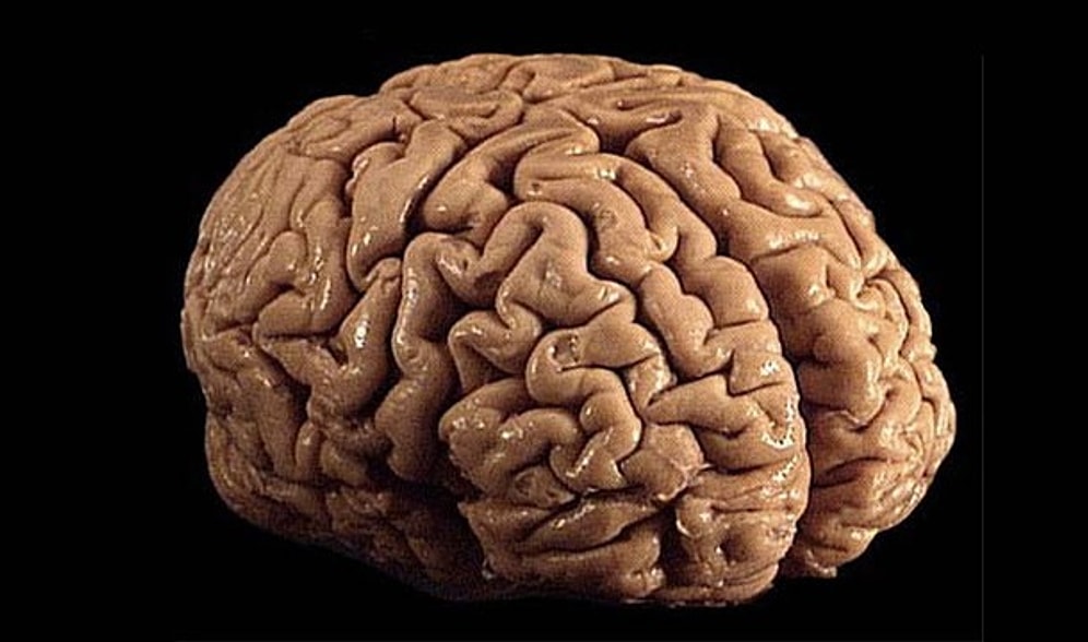 The Easiest Ways to Clear Brain Fog