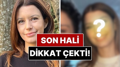 Beren Saat'in Son Hali Sosyal Medyada Estetik İddialarını Alevlendirdi!