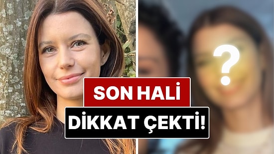 Beren Saat'in Son Hali Sosyal Medyada Estetik İddialarını Alevlendirdi!