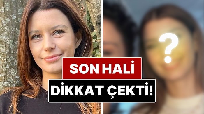 Beren Saat'in Son Hali Sosyal Medyada Estetik İddialarını Alevlendirdi!