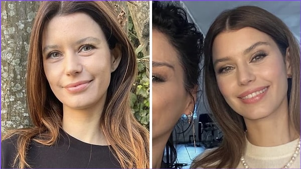 Beren Saat, kariyerinin ilk yıllarından bu yana hem oyunculuğu hem de doğal güzelliğiyle öne çıkan isimlerden biri oldu.