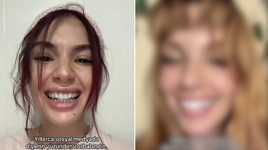 Content Creator Reveals Her Amazing 1.5-Year Transformation with Clear Aligner Treatment
