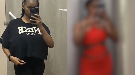 Woman with Gigantomastia Shares Her Transformation After Breast Reduction Surgery