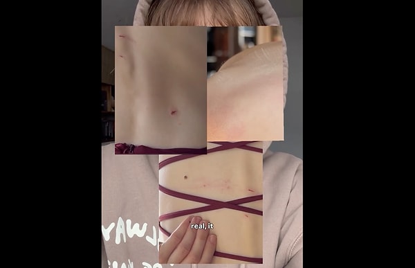 He shared both the outcome that emerged and the wounds he received.