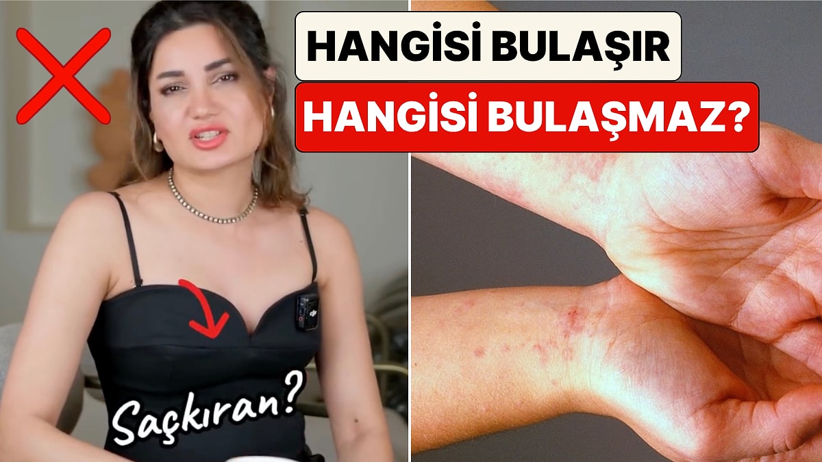 Uzman Dermatolog Cilt Hastalıklarının Hangilerinin Bulaşıcı Hangilerinin Olmadığını Anlattı