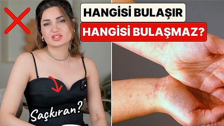 Uzman Dermatolog Cilt Hastalıklarının Hangilerinin Bulaşıcı Hangilerinin Olmadığını Anlattı