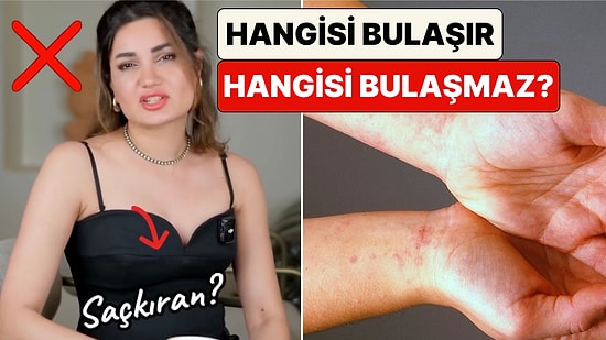 Uzman Dermatolog Cilt Hastalıklarının Hangilerinin Bulaşıcı Hangilerinin Olmadığını Anlattı