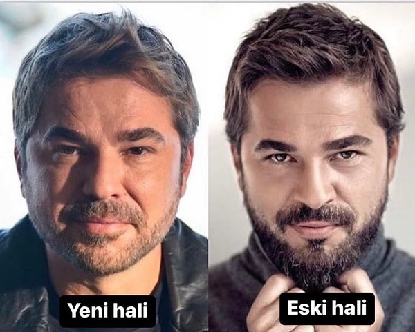 Engin Altan Düzyatan, son dönemde sosyal medyada sıkça konuşulan estetik iddialarına sonunda açıklık getirdi.