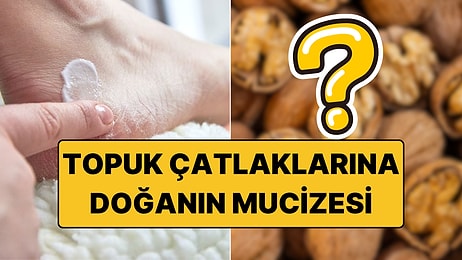 Çöp Diye Atıyoruz Halbuki Topuk Çatlaklarından 15 Dakikada Kurtulmayı Sağlıyor!
