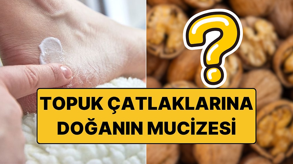 Çöp Diye Atıyoruz Halbuki Topuk Çatlaklarından 15 Dakikada Kurtulmayı Sağlıyor!