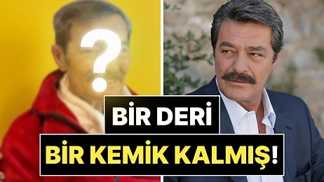 Aylardır Tedavi Gören 77 Yaşındaki Kadir İnanır'ın Son Hali Sevenlerini Korkuttu!