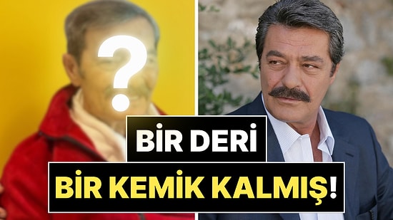 Aylardır Tedavi Gören 77 Yaşındaki Kadir İnanır'ın Son Hali Sevenlerini Korkuttu!