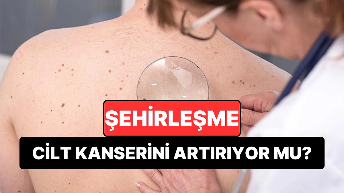 Şehirleşme Cilt Kanseri Riskini Artırıyor: Uzmanlardan Kritik “Ben Taraması” Uyarısı