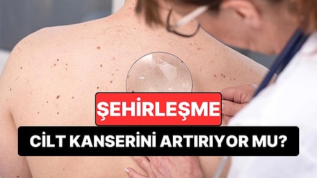 Şehirleşme Cilt Kanseri Riskini Artırıyor: Uzmanlardan Kritik “Ben Taraması” Uyarısı
