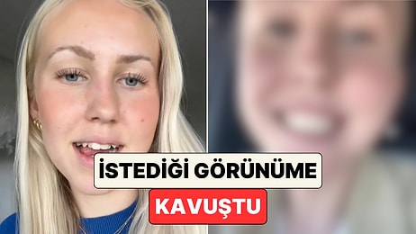 Ortodonti Tedavisi Dişleri Nasıl Değiştiriyor? Bir Kadın Aylar İçinde Yaşadığı Değişimi Paylaştı