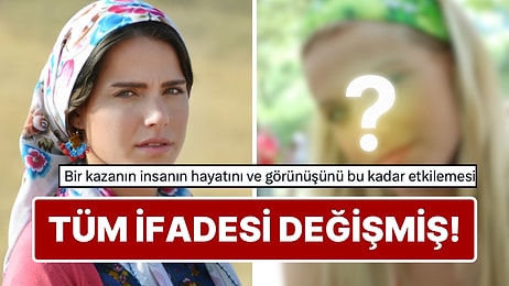 Sette Yaşadığı Talihsiz Kazayı İlk Kez Anlattı: Ceyda Ateş 3 Kez Ameliyat Masasına Yattı