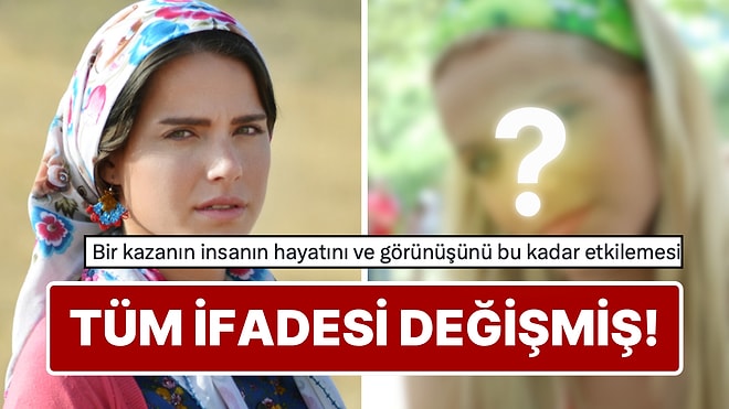 Sette Yaşadığı Talihsiz Kazayı İlk Kez Anlattı: Ceyda Ateş 3 Kez Ameliyat Masasına Yattı