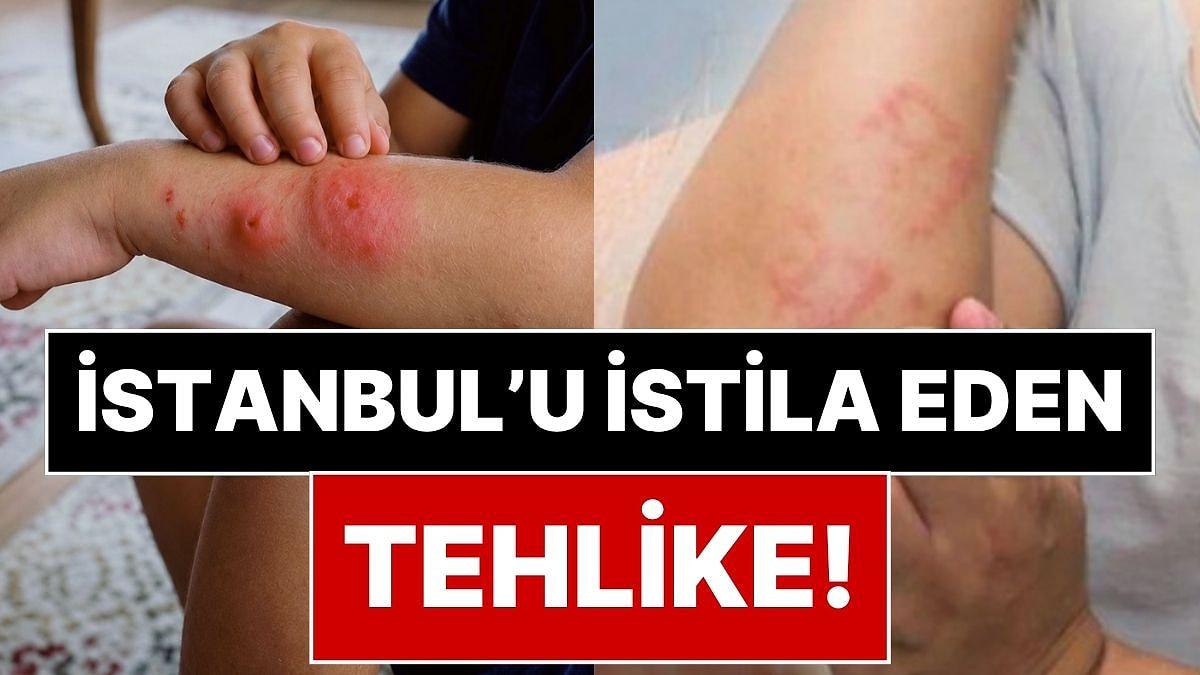 İstanbul'da Aileleri İsyan Ettiren Tehlike: Gündüz Bile Saldırıp Hastanelik Ediyorlar