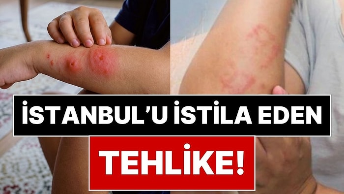 İstanbul'da Aileleri İsyan Ettiren Tehlike: Gündüz Bile Saldırıp Hastanelik Ediyorlar