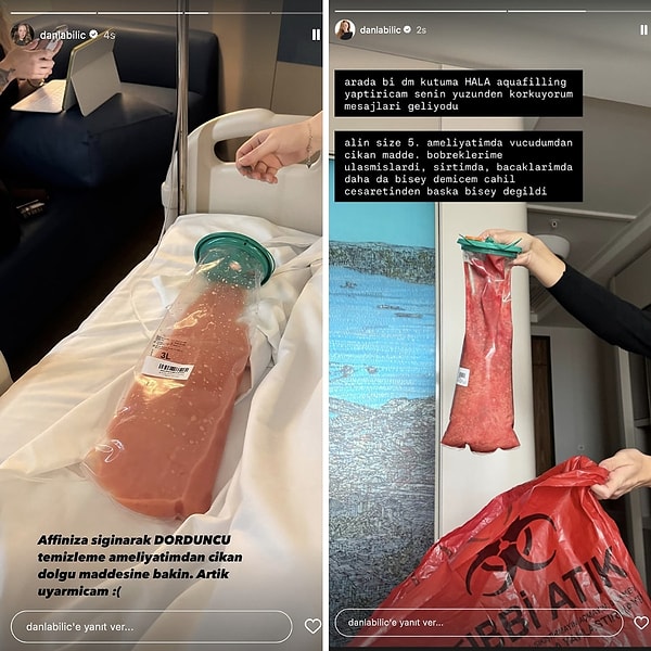 Attığı her adımla olay olan Danla Bilic'in özellikle son iki yıldır dilinden düşürmediği tek bir konu var: bir dolgu meselesi!