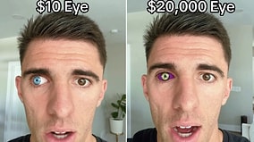 From $10 to $100,000: Man Shares Fascinating Designs and Costs of Prosthetic Eyes