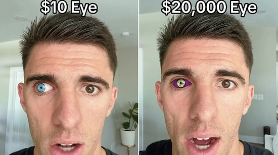 From $10 to $100,000: Man Shares Fascinating Designs and Costs of Prosthetic Eyes