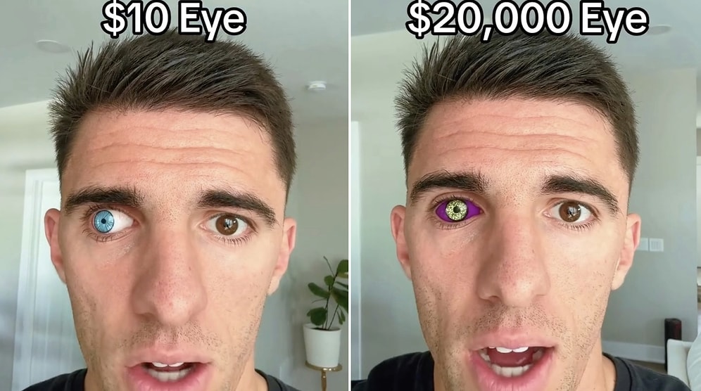 From $10 to $100,000: Man Shares Fascinating Designs and Costs of Prosthetic Eyes