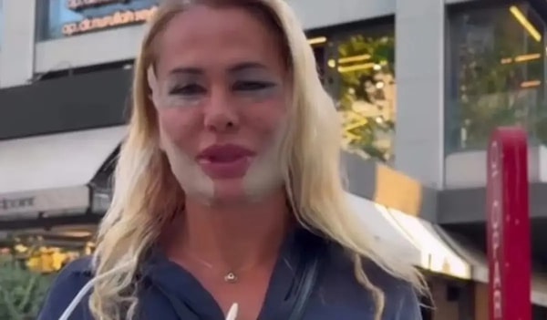 Nagihan Karadere opted for cosmetic surgery as her first course of action following Survivor.