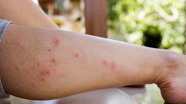 Aromatic herbs can assist in warding off mosquitoes.
