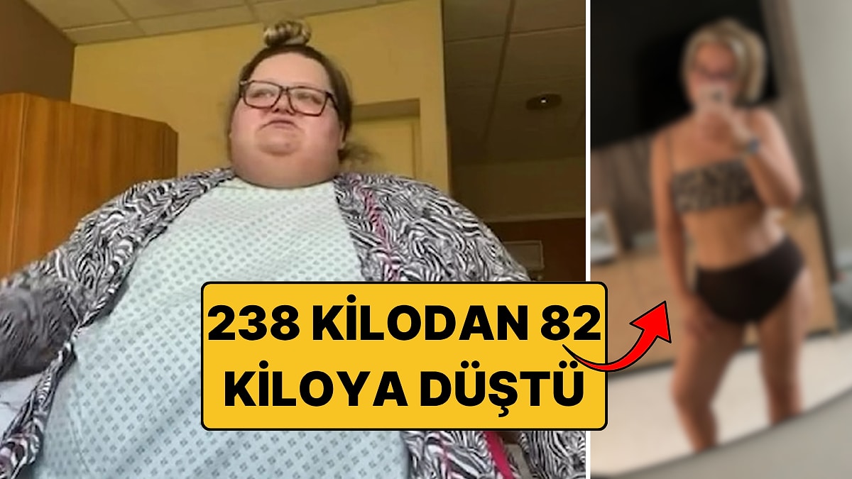 "30 Yaşını Göremezsin" Denildi: 152 Kilo Vererek 238 Kilodan 82 Kiloya Düştü
