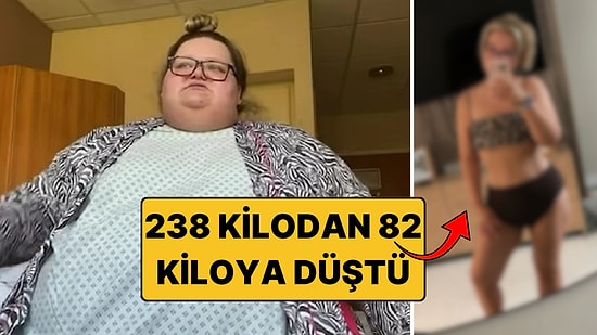 "30 Yaşını Göremezsin" Denildi: 152 Kilo Vererek 238 Kilodan 82 Kiloya Düştü