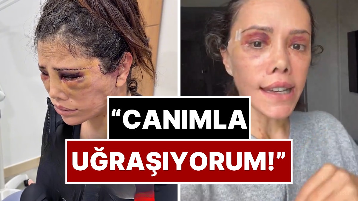 Estetik Kabusunun Ortasında Kalan Didem Ceran Yaşadığı Olaylar Karşısında Sinirlerine Hakim Olamadı