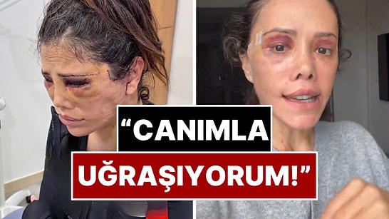 Estetik Kabusunun Ortasında Kalan Didem Ceran Yaşadığı Olaylar Karşısında Sinirlerine Hakim Olamadı