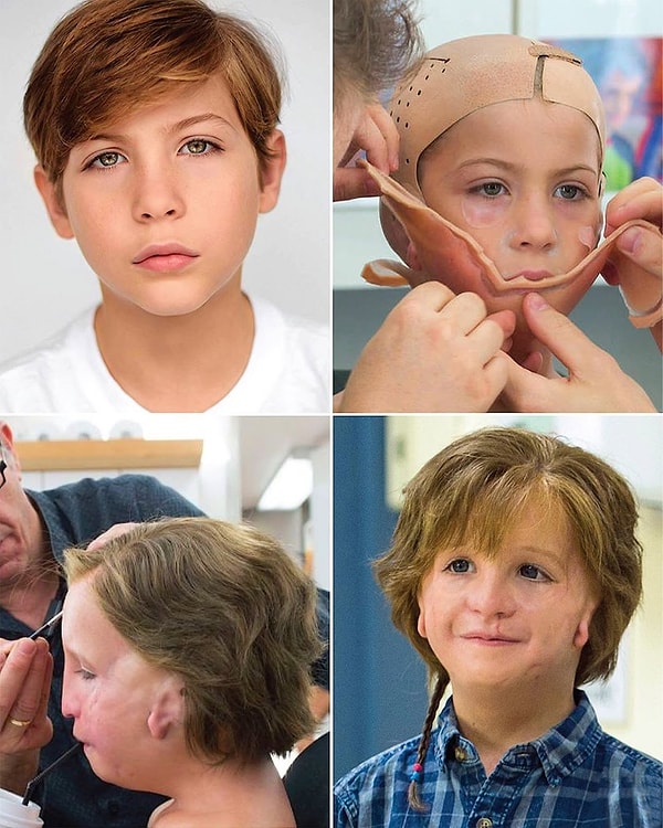 Wonder'ı izleyen pek çok kişi, Jacob Tremblay'in yüzünün gerçekten bu şekilde olduğunu düşündü.