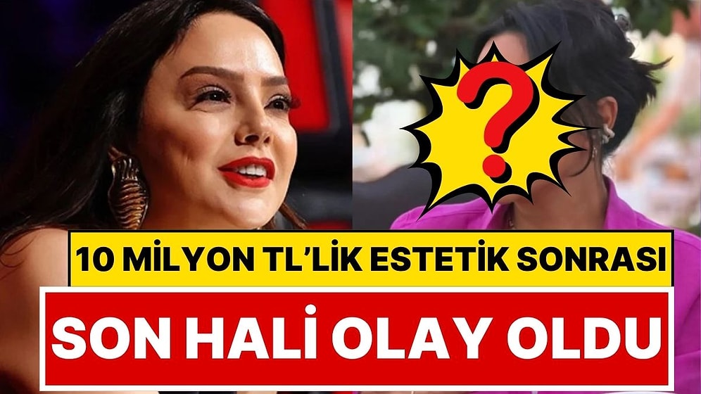 Ebru Gündeş'in 10 Milyon TL'lik Estetik Ameliyat Sonrası Son Hali Sosyal Medyada Gündem Oldu
