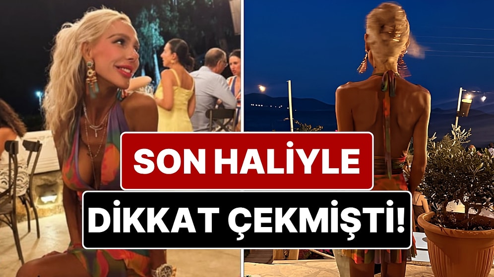 Son Haliyle Endişelendiren Hande Demir'den Zayıflama İddialarına ve Eleştirilere Yanıt