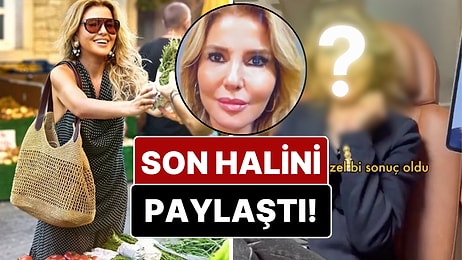 Gülben Ergen Yaptırdığı "Tüm Yüz Gençleştirme" İşleminden Sonra Son Halini Gösterdi!