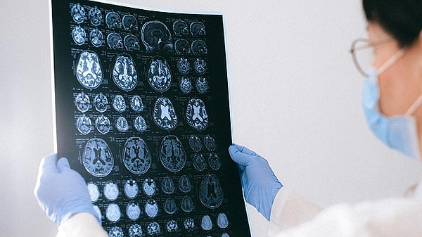 The Power That Stops "Rust" in the Brain