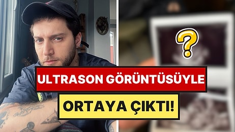 Ufuk Beydemir Baba Oluyor: Haberi Alır Almaz Sevgilisinin Yanına Koşmuş