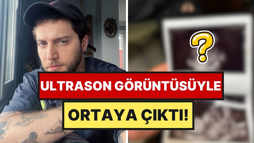 Ufuk Beydemir Baba Oluyor: Haberi Alır Almaz Sevgilisinin Yanına Koşmuş