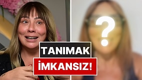 75 Kilo Veren Işın Karaca’nın Yüzündeki Değişim Şaşırttı!