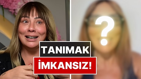 75 Kilo Veren Işın Karaca’nın Yüzündeki Değişim Şaşırttı!