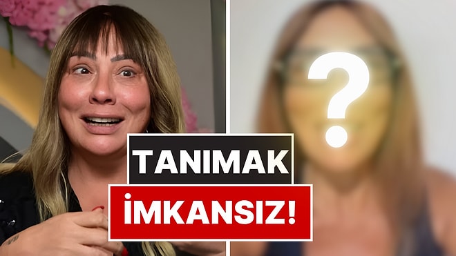 75 Kilo Veren Işın Karaca’nın Yüzündeki Değişim Şaşırttı!
