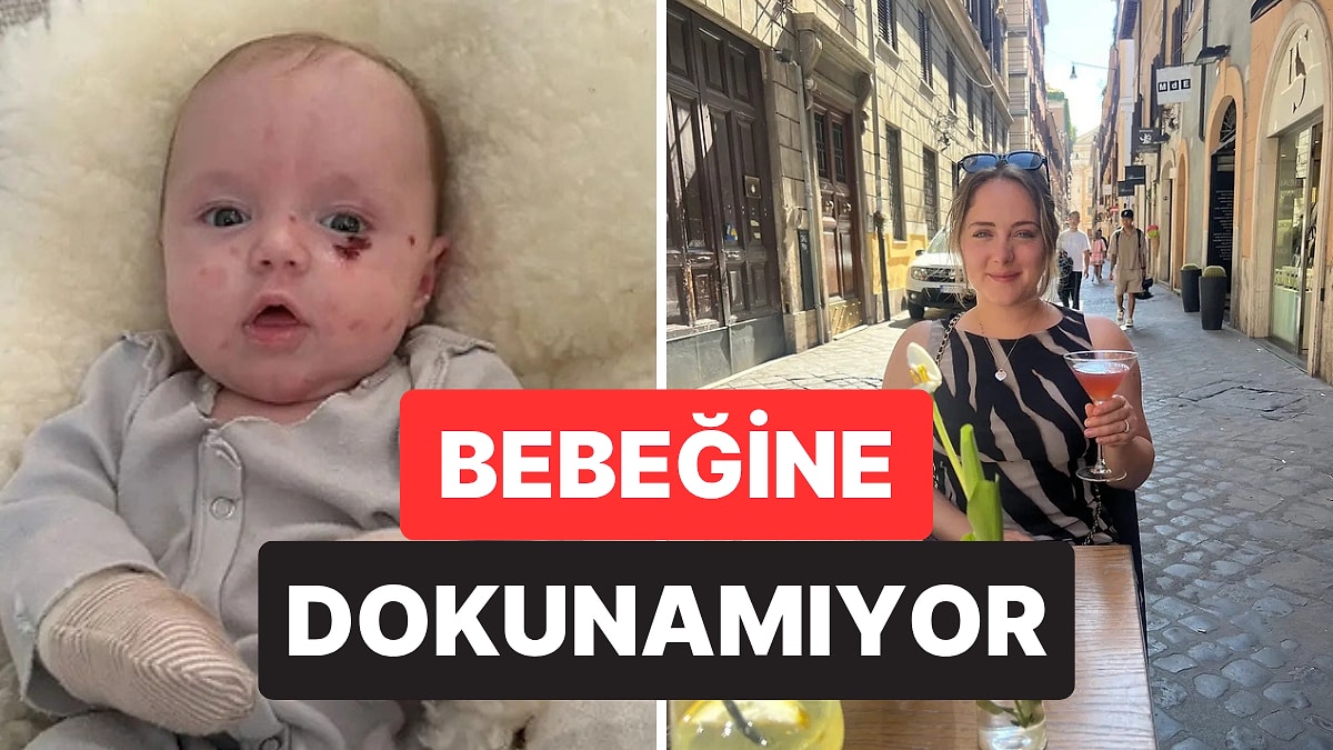 Nadir Hastalığı Nedeniyle Bebeğine Dokunamayan Anne Yaşadıklarını Anlattı