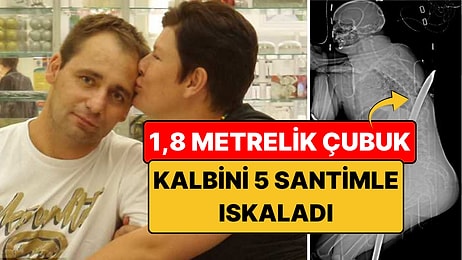 Vücuduna 1,8 Metrelik Çubuk Saplandı: 3 Yıl Sonra 90 KM Koştu