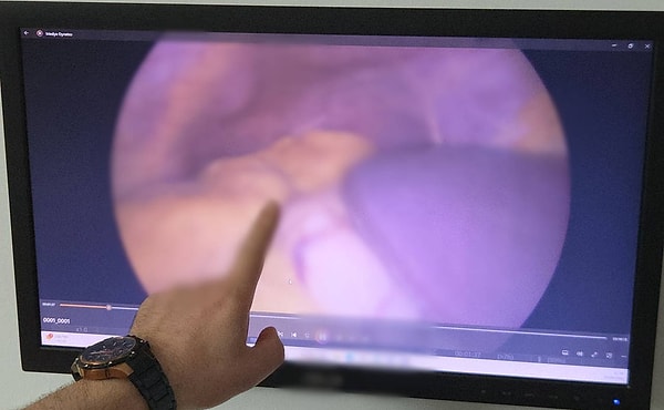 Diğer organları da ters çıktı.