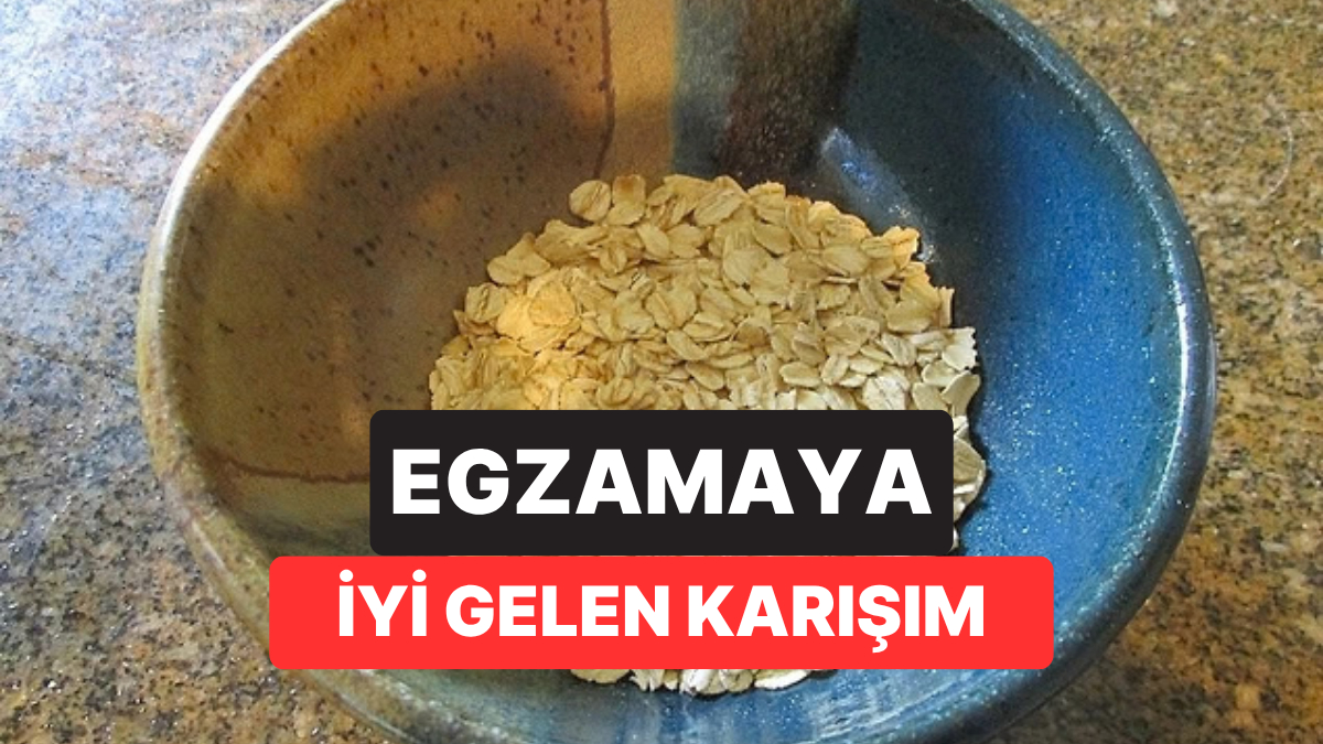 Kaşıntıyı Evde Dindirmek İsteyenler Dikkat: Dermatologlar O Karışımdaki Tek Malzemeye Karşı Uyarıyor