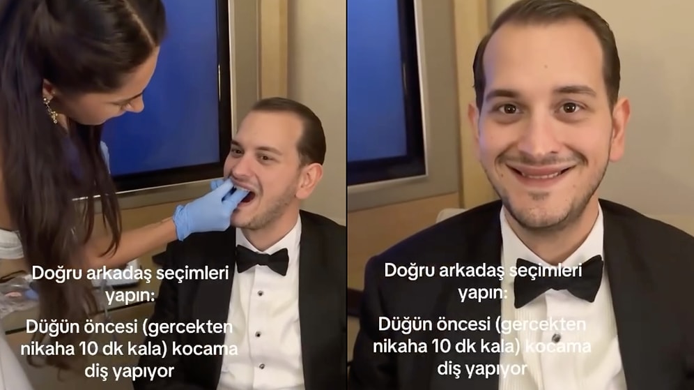 Bride's Dentist Friend Fixes Groom's Teeth 10 Minutes Before Wedding