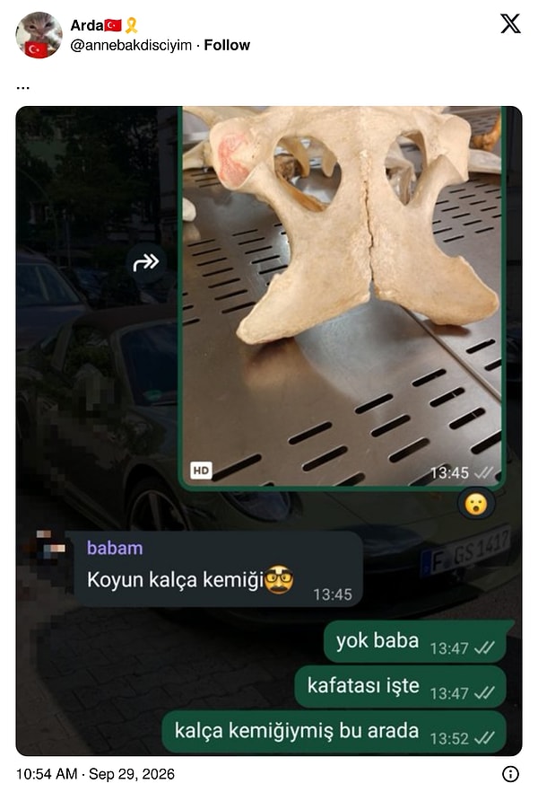 Babanın bir bakışta bildiği kemiği diş hekimliği öğrencisi bilemedi