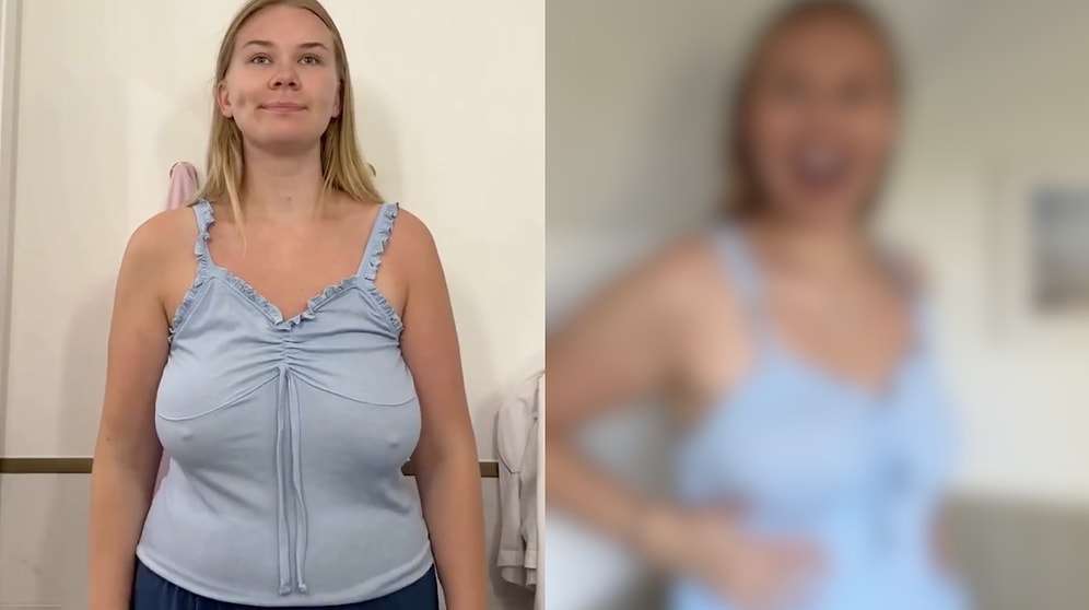 Content Creator Reveals How Breast Reduction Surgery Completely Changed Her Life